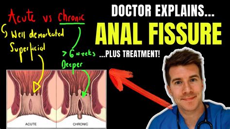 Anal fistin. Things To Know About Anal fistin. 